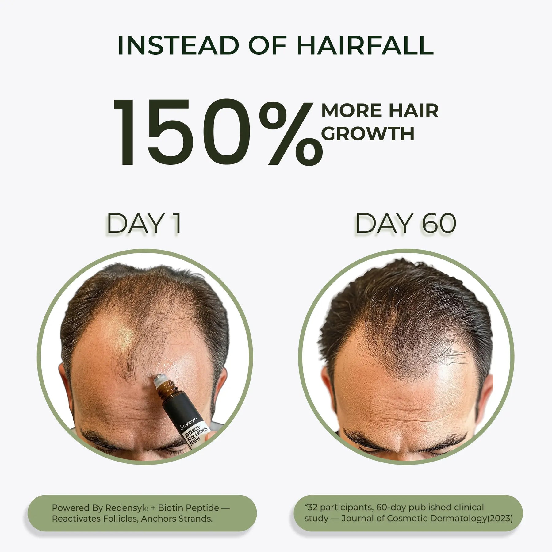 Advanced Hair Growth Serum Roll-On – Redensyl, Anagain & Caffeine, DHT Blocker, 3x10ml
