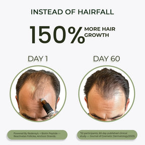 Advanced Hair Growth Serum Roll-On – Redensyl, Anagain & Caffeine, DHT Blocker, 3x10ml