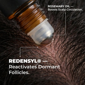 Advanced Hair Growth Serum Roll-On – Redensyl, Anagain & Caffeine, DHT Blocker, 3x10ml
