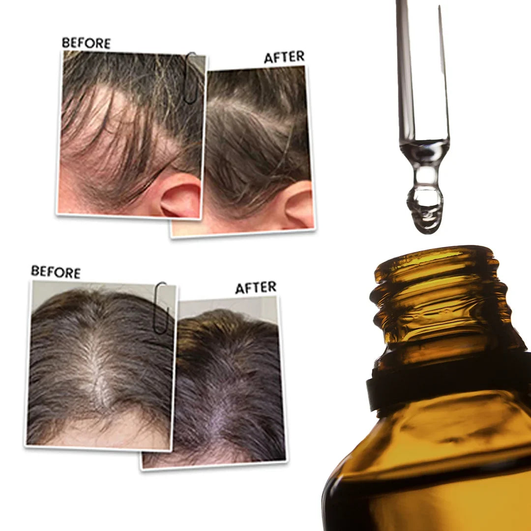 Rosemary Mint Hair Oil – RootBioTec HO & Peppermint for Growth & Scalp Care, 50ml