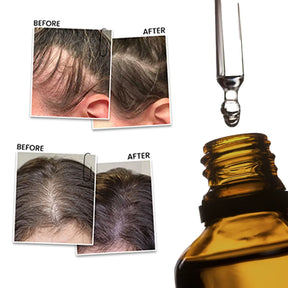 Rosemary Mint Hair Oil – RootBioTec HO & Peppermint for Growth & Scalp Care, 50ml